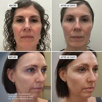 SKOON. RETININ NIGHT Face Cream